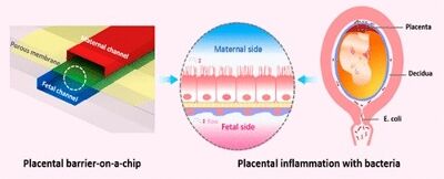 Placental Barrier-on-a-Chip: Modeling Placental Inflammatory Responses to Bacterial Infection
