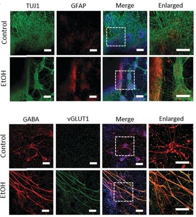 Probing impaired neurogenesis in human brain organoids exposed to alcohol